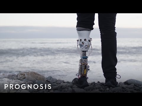 Un ingénieur MIT construit sa propre prothèse de jambe bionique