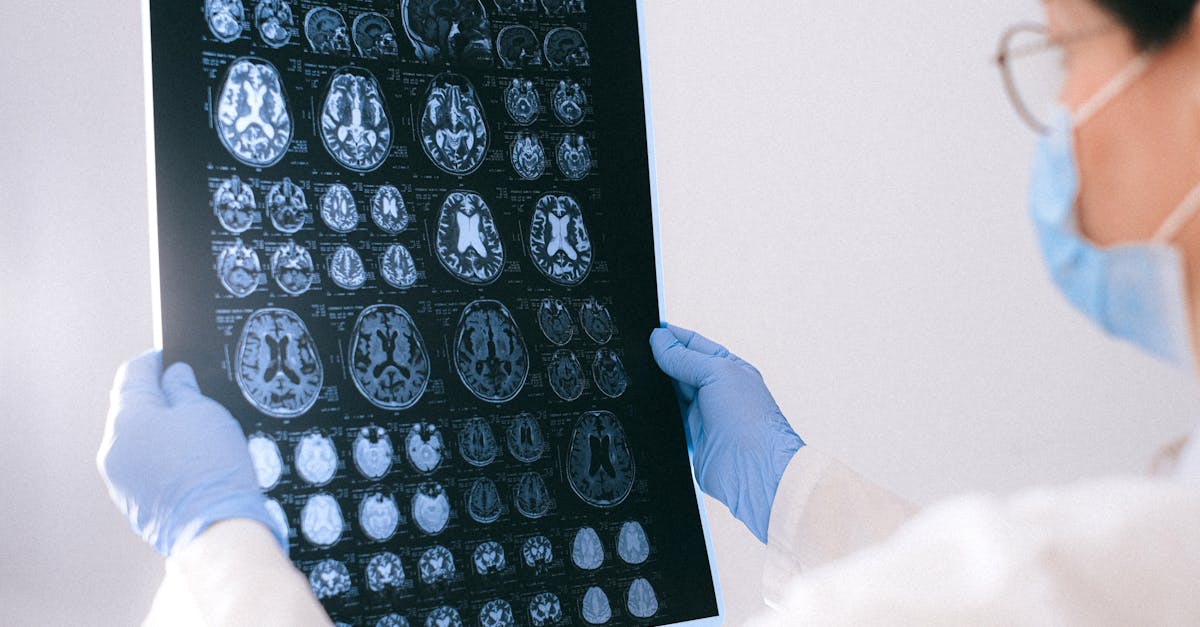 Researcher in white coat analyzing neurons and amyloid plaques in the brain under a microscope